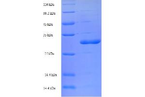 SDS-PAGE (SDS) image for Transmembrane Protein 66 (TMEM66) (AA 195-339) protein (His-SUMO Tag) (ABIN5711690)