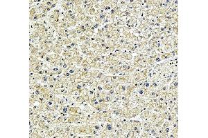 anti-Sprouty-Related, EVH1 Domain Containing 2 (SPRED2) (AA 40-298) antibody