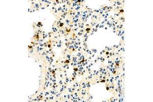 Immunohistochemistry analysis of paraffin embedded mouse lung using S100A9 (ABIN7075497) at dilution of 1: 1800