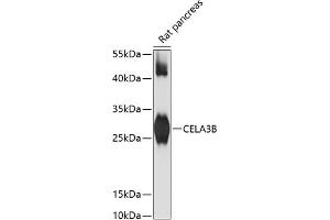 Western blot analysis of extracts of rat pancreas, using CELB antibody (ABIN6133505, ABIN6138397, ABIN6138398 and ABIN6217810) at 1:3000 dilution.