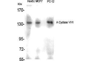Western Blot (WB) analysis of specific cells using A Cyclase V/VI Polyclonal Antibody. (ADCY5/6 anticorps  (C-Term))
