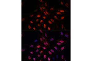 Immunofluorescence analysis of U-2 OS cells using TPI1 antibody (ABIN7270977) at dilution of 1:100. (TPI1 anticorps  (AA 1-249))