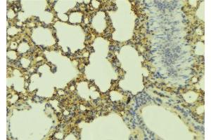 ABIN6277452 at 1/100 staining Mouse lung tissue by IHC-P. (ADCYAP1R1 anticorps  (C-Term))