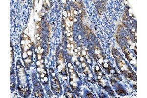 IHC analysis of TRK fused gene/TFG using anti-TRK fused gene/TFG antibody (ABIN7599839). (TFG anticorps  (AA 121-400))