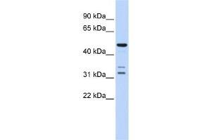 Western Blotting (WB) image for anti-HtrA Serine Peptidase 4 (HTRA4) antibody (ABIN2459938) (HTRA4 anticorps)