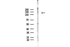 anti-RAN Binding Protein 17 (RANBP17) (N-Term) antibody