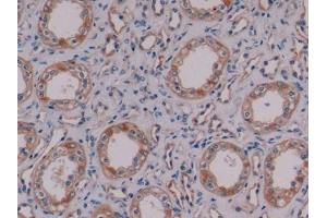 Detection of NES in Human Kidney Tissue using Monoclonal Antibody to Nestin (NES) (Nestin anticorps  (AA 178-399))