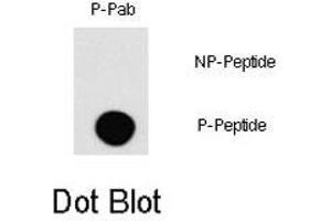 Dot blot analysis of MAP3K1 (phospho T1383) polyclonal antibody  on nitrocellulose membrane.
