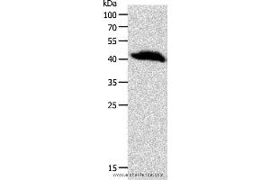 Western blot analysis of Human liver cancer tissue, using OPRL1 Polyclonal Antibody at dilution of 1:900