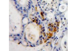 Used in DAB staining on fromalin fixed paraffin-embedded Pancreas tissue (MNDA anticorps  (AA 189-405))