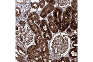 Immunohistochemical staining of human kidney with C10orf67 polyclonal antibody  shows strong cytoplasmic and membranous positivity in cells of tubules. (C10orf67 anticorps)