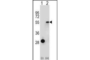 Western blot analysis of ESRRA (arrow) using rabbit polyclonal ESRRA Antibody (Center) (ABIN652575 and ABIN2842387). (ESRRA anticorps  (AA 131-159))
