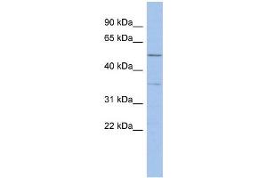 Human ACHN; WB Suggested Anti-ABHD15 Antibody Titration: 0. (ABHD15 anticorps  (Middle Region))
