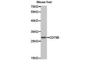 Western Blotting (WB) image for anti-CD79b Molecule, Immunoglobulin-Associated beta (CD79B) antibody (ABIN1871654) (CD79b anticorps)