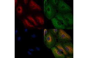 ABIN6262303 and ABIN6276781 staining  cells by IF/ICC. (HMGCR anticorps  (N-Term))