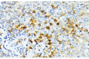 Immunohistochemistry of paraffin-embedded Human tonsil using SPTA1 Polyclonal Antibody at dilution of 1:100 (40x lens). (SPTA1 anticorps)