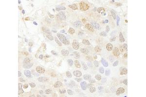 Immunohistochemistry (IHC) image for anti-SET Domain Containing 8 Pseudogene 1 (SETD8P1) (AA 316-366) antibody (ABIN7448789) (SET7 anticorps  (AA 316-366))