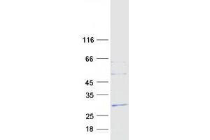 Validation with Western Blot