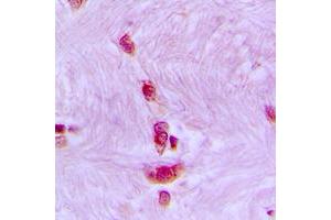 Immunohistochemical analysis of CDC40 staining in human brain formalin fixed paraffin embedded tissue section.