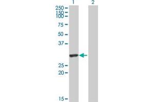 Western Blot analysis of HYAL1 expression in transfected 293T cell line by HYAL1 MaxPab polyclonal antibody.