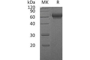 Western Blotting (WB) image for Chordin-Like 2 (CHRDL2) protein (His tag) (ABIN7320490) (CHRDL2 Protein (His tag))