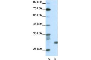 Western Blotting (WB) image for anti-Sin3A-Associated Protein, 30kDa (SAP30) antibody (ABIN2461707) (SAP30 anticorps)