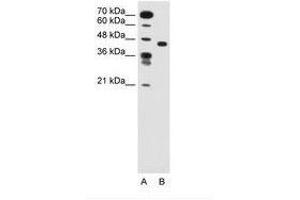 Image no. 1 for anti-Solute Carrier Family 35, Member C1 (SLC35C1) (AA 51-100) antibody (ABIN205019) (SLC35C1 anticorps  (AA 51-100))