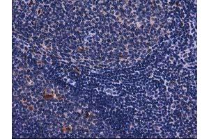 Image no. 1 for anti-Sequestosome 1 (SQSTM1) antibody (ABIN1499987) (SQSTM1 anticorps)