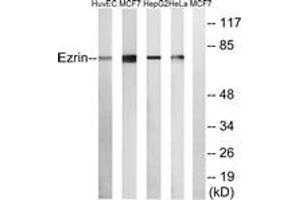 Western blot analysis of extracts from HuvEc/MCF-7/HepG2/HeLa cells, using Ezrin Antibody. (Ezrin anticorps  (AA 511-560))