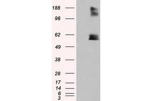 HEK293T cells were transfected with the pCMV6-ENTRY control (Left lane) or pCMV6-ENTRY LIPG (Right lane) cDNA for 48 hrs and lysed. (LIPG anticorps)