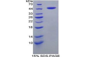 SDS-PAGE analysis of Human CRH Protein. (CRH Protéine)