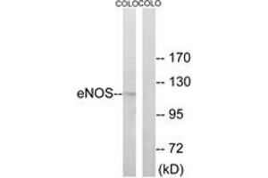 Western Blotting (WB) image for anti-Nitric Oxide Synthase 3 (Endothelial Cell) (NOS3) (AA 462-511) antibody (ABIN2888982) (ENOS anticorps  (AA 462-511))