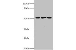 Western blot All lanes: BAG family molecular chaperone regulator 5 antibody at 2 μg/mL Lane 1: Mouse kidney tissue Lane 2: Mouse brain tissue Lane 3: Hela whole cell lysate Secondary Goat polyclonal to rabbit IgG at 1/10000 dilution Predicted band size: 52, 57 kDa Observed band size: 52 kDa (BAG5 anticorps  (AA 1-447))