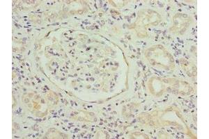 Immunohistochemistry of paraffin-embedded human kidney tissue using ABIN7169799 at dilution of 1:100 (SLITRK4 anticorps  (AA 201-500))