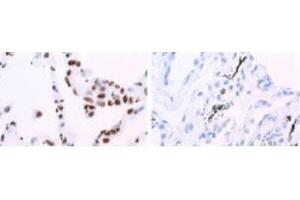 Image no. 3 for anti-Heterogeneous Nuclear Ribonucleoprotein A1 (HNRNPA1) antibody (ABIN108609) (HNRNPA1 anticorps)