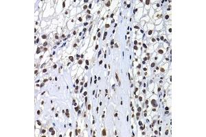 Immunohistochemistry of paraffin-embedded human kidney cancer using macroH2A.