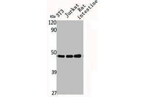 Western Blot analysis of NIH-3T3 Jurkat RAT-intestine cells using CSN3 Polyclonal Antibody (COPS3 anticorps  (Internal Region))