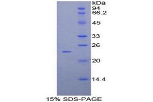 SDS-PAGE analysis of Mouse Protocadherin beta 2 Protein.