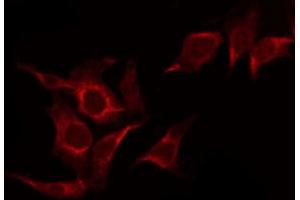 ABIN6267368 staining HepG2 by IF/ICC. (FGFR1 anticorps  (pTyr766))