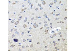 Immunohistochemistry of paraffin-embedded Mouse brain using CHRNB2 Polyclonal Antibody at dilution of 1:100 (40x lens). (CHRNB2 anticorps)