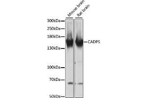 Western blot analysis of extracts of various cell lines, using CADPS antibody (ABIN6131298, ABIN6137843, ABIN6137844 and ABIN6217089) at 1:3000 dilution. (CADPS anticorps  (AA 1020-1100))