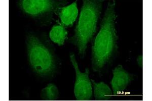 Immunofluorescence of monoclonal antibody to RAB3A on HeLa cell. (RAB3A anticorps  (AA 122-220))