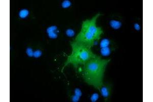 Anti-RBBP9 mouse monoclonal antibody (ABIN2453591) immunofluorescent staining of COS7 cells transiently transfected by pCMV6-ENTRY RBBP9 (RC202090). (RBBP9 anticorps)