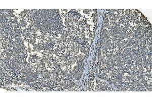 IHC analysis of LSM8 using anti-LSM8 antibody (ABIN7599579). (NAA38 anticorps  (AA 1-96))