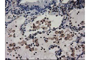 Immunohistochemical staining of paraffin-embedded Human Kidney tissue using anti-ADSL mouse monoclonal antibody.