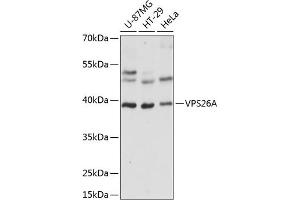 Western blot analysis of extracts of various cell lines, using VPS26A antibody  at 1:1000 dilution. (VPS26A anticorps  (AA 208-327))