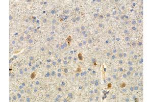 Phospho-Paxillin (Ser178) Antibody at 1/100 staining Mouse brain tissue by IHC-P. (Paxillin anticorps  (pSer178))