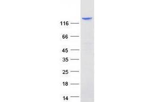Validation with Western Blot