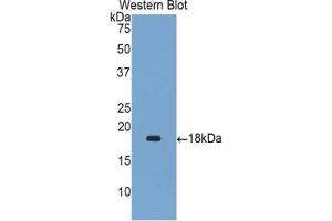 Western blot analysis of the recombinant protein. (Gastrokine 1 anticorps  (AA 53-192))