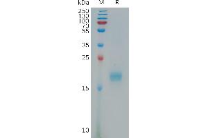 Human IL17F Protein, His Tag on SDS-PAGE under reducing condition.